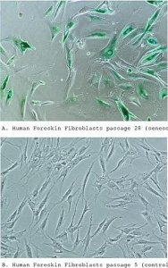 Senescence Cells Histochemical Staining Kit 