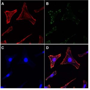 Actin Cytoskeleton / Focal Adhesion Staining Kit FAK100