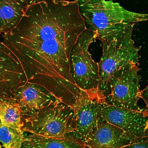 Actin Cytoskeleton / Focal Adhesion Staining Kit FAK100