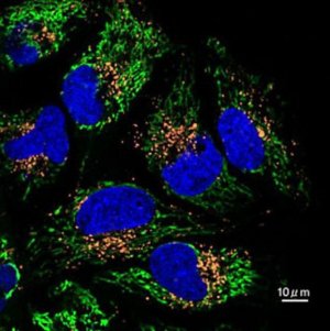 BioTracker 560 Orange Lysosome Dye SCT019