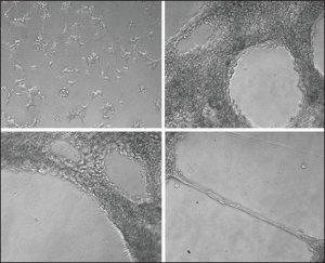 Collagen from Engelbreth-Holm-Swarm murine sarcoma basement membrane 
