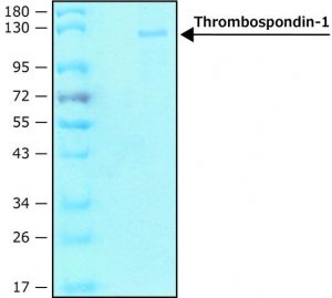 Thrombospondin-1 human 