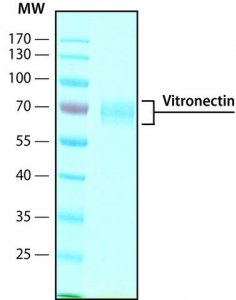 Vitronectin human 