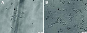 Brain-derived neurotrophic factor human 