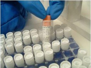 CHOZN CHO K1 Host Cell Line CHOK1-1VL