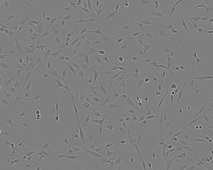 1321N1 Cell Line human 