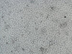 K562 Cell line human 