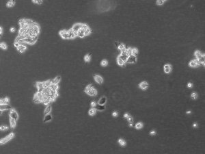 LoVo Cell Line human 