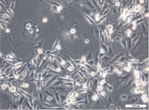 MDA-MB-231 Cell Line human 