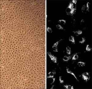 Bovine Aortic Endothelial Cells: BAOEC (Cryovial) B304-05