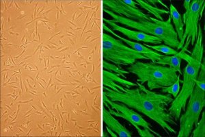Hair Follicle Dermal Papilla Cells: HFDPC, adult 602-05A