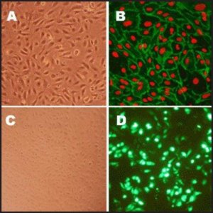 Human Aortic Endothelial Cells: HAOEC, adult 304-05A