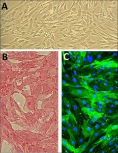 Human Aortic Smooth Muscle Cells: HAOSMC, fetal 354-05F