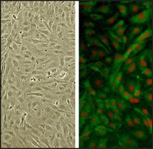 Human Brachiocephalic Artery Endothelial Cells: HBcAEC, adult 3012-05A