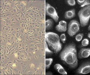 Human Bronchial Epithelial Cells: HBEpC, adult 502-05A