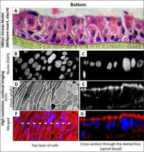 Human Bronchial Epithelial Cells: HBEpC, adult 502-05A