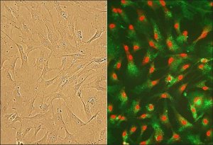 Human Cardiac Fibroblasts: HCF, fetal 306-05F