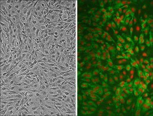 Human Carotid Artery Endothelial Cells: HCtAEC, adult 3014-05A