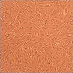 Human Chondrocytes - Rheumatoid Arthritis: HC-RA, adult 402RA-05A