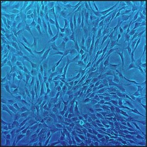 Human Chondrocytes: HC, fetal 402-05F