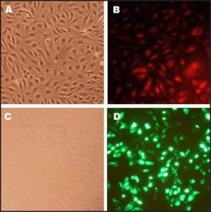 Human Coronary Artery Endothelial Cells: HCAEC, adult 300-05A