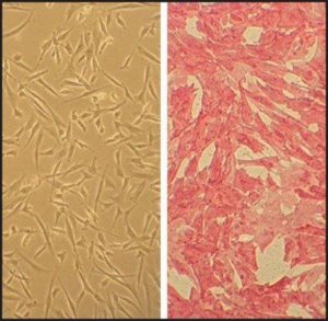Human Coronary Artery Smooth Muscle Cells: HCASMC, adult 350-05A