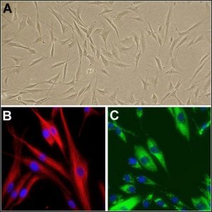 Human Dermal Fibroblasts: HDF, fetal 106-05F