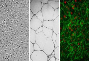 Human Dermal Microvascular Endothelial Cells: CADMEC/HMVEC, adult 100-05A