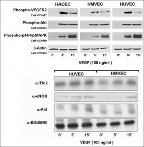 Human Dermal Microvascular Endothelial Cells: CADMEC/HMVEC: Pre-Screened for Angiogenesis & VEGF signaling, neonatal S100-05N