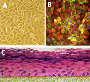 Human Epidermal Keratinocytes: HEK, neonatal 102-05N