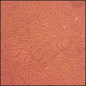 Human Fibroblast-Like Synoviocytes-Osteoarthritis: HFLS-OA, adult 408OA-05A