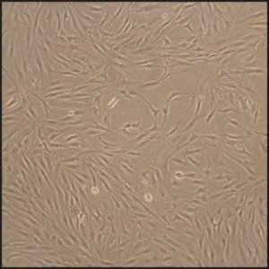 Human Fibroblast-Like Synoviocytes: HFLS, adult 408-05A