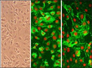 Human Internal Thoracic Artery Endothelial Cells: HITAEC, adult 308-05A
