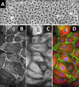 Human Mammary Epithelial Cells: HMEpC, adult 830-05A