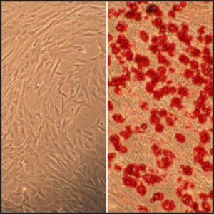 Human Marrow Stromal Cells: HMSC, fetal 492-05F