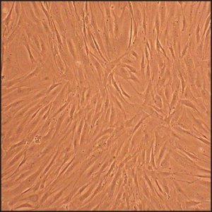 Human Osteoblasts-Rheumatoid Arthritis: HOb-RA, adult 406RA-05A