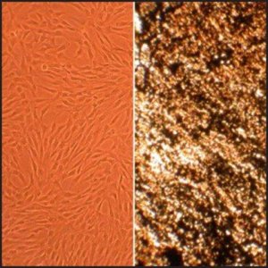 Human Osteoblasts: HOb, fetal 406-05F