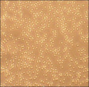Human Peripheral Blood T Cells: HPBT 6902-50A