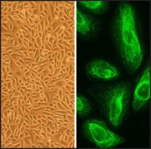 Human Placental Epithelial Cells: HPlEpC, fetal 230-05F