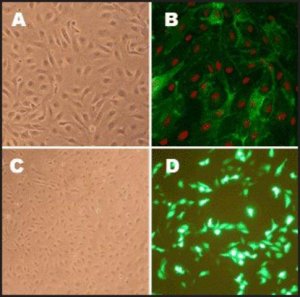 Human Pulmonary Artery Endothelial Cells: HPAEC, adult 302-05A