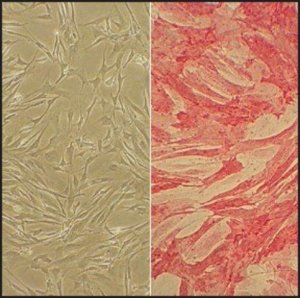 Human Pulmonary Artery Smooth Muscle Cells: HPASMC, adult 352-05A