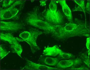 Human Renal Proximal Tubular Epithelial Cells: HRPTEpC, adult 930-05A