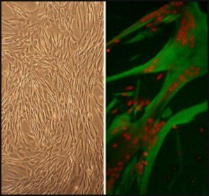 Human Skeletal Muscle Cells: HSkMC, fetal 150-05F