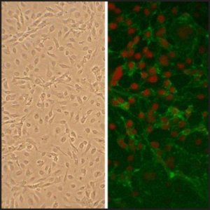 Human Subclavian Artery Endothelial Cells: HScAEC, adult 3010-05A