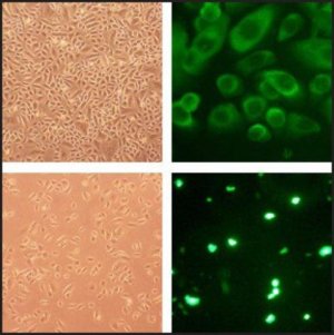 Human Tracheal Epithelial Cells: HTEpC, adult 504-05A