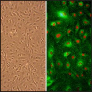 Human Umbilical Artery Endothelial Cells: HUAEC, neonatal 202-05N