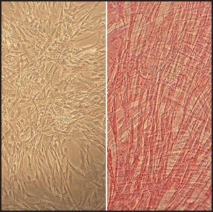 Human Umbilical Artery Smooth Muscle Cells: HUASMC, neonatal 252-05N