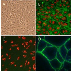 Human Umbilical Vein Endothelial Cells: HUVEC, neonatal 200-05N