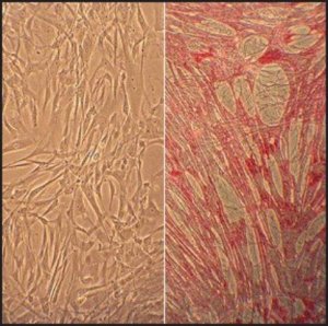 Human Umbilical Vein Smooth Muscle Cells: HUVSMC, neonatal 250-05N