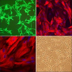 Rat Astrocytes: RA, neonatal R882A-05N